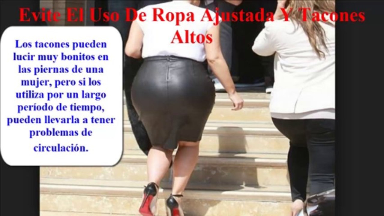 Cómo Prevenir La Aparición De Las Várices