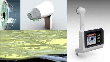 C-Eye - Un traitement innovant contre les infections de la cornée