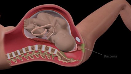 Should I have been tested for Group B strep?