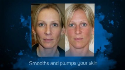 Vitamin C Serum: An Online Guide