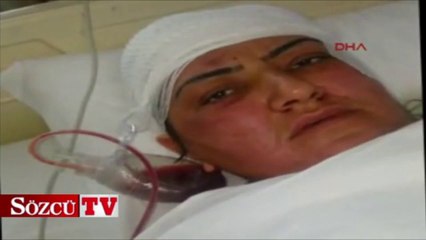 Evlilik teklifini kabul etmeyen kadına satırla saldırdı