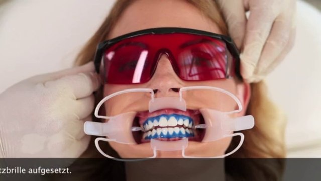 Zahnbleaching, Zahnaufhellung, Lydenti Bleaching, Whitening, Wybielanie, Power-bleaching,