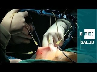 Beatriz en el quirófano: mastectomía para evitar el cáncer