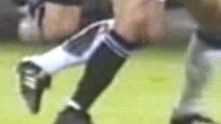 Soccer Broken Leg Accident
