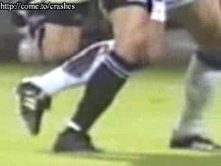 Soccer Broken Leg Accident