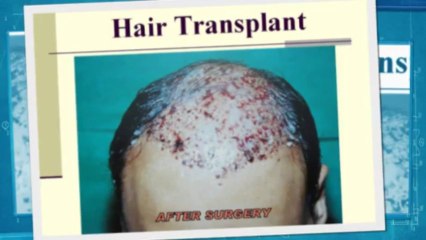 What Much Does Bosley Cost