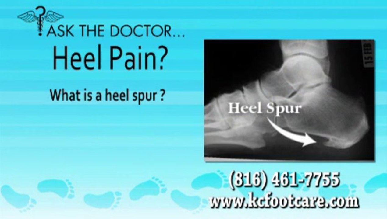 Do I Have A Heel Spur? Overland Park, KS  and Kansas City, MO -  KC Foot Care