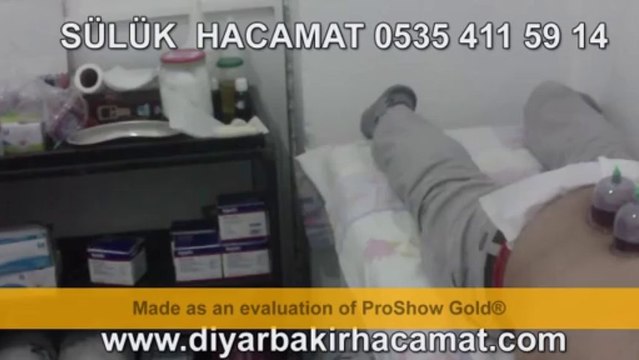 DİYARBAKIR HACAMAT 0535 411 59 14