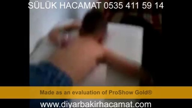 HACAMAT SÜLÜK TEDAVİSİ DİYARBAKIR 0535 411 59 14