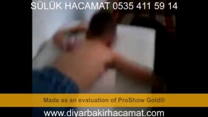 HACAMAT SÜLÜK TEDAVİSİ DİYARBAKIR 0535 411 59 14