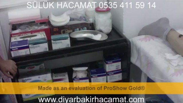 HACAMAT SÜLÜK DİYARBAKIR TEDAVİ MERKEZİ 0535 411 59 14