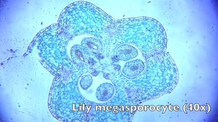 Turning a Smartphone into a Digital Microscope
