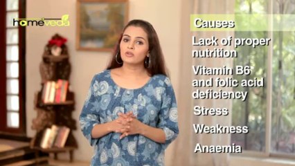 Download Video: Hair Care - Hair Loss - Natural Ayurvedic Home Remedies