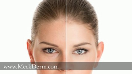 Dermatologist Charlotte North Carolina 704-344-8846