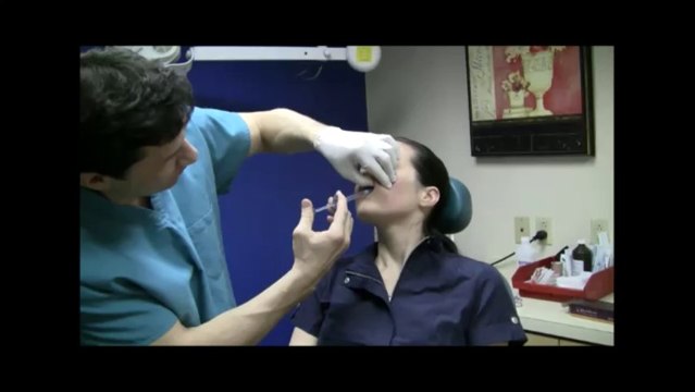 Instant Cheeks - Juvederm Treatment - New York - Dr. Philip Miller