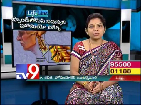 Homeo treatment for Spondylosis problems - Life Line