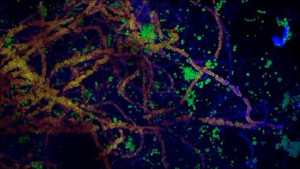 ¿Cómo se combate el mal verde en las cuevas turísticas?