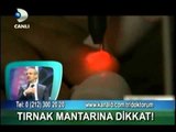 Tırnak Mantarı Nasıl Tedavi Edilir-Tırnaklarda Mantar Tedavisi