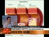 Damar Açıcı Bitkiler Hangileri-Damar Tıkanıklığına Bitkisel Çözümler