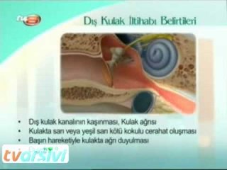 Dış Kulak İltihabı Belirtileri Nelerdir