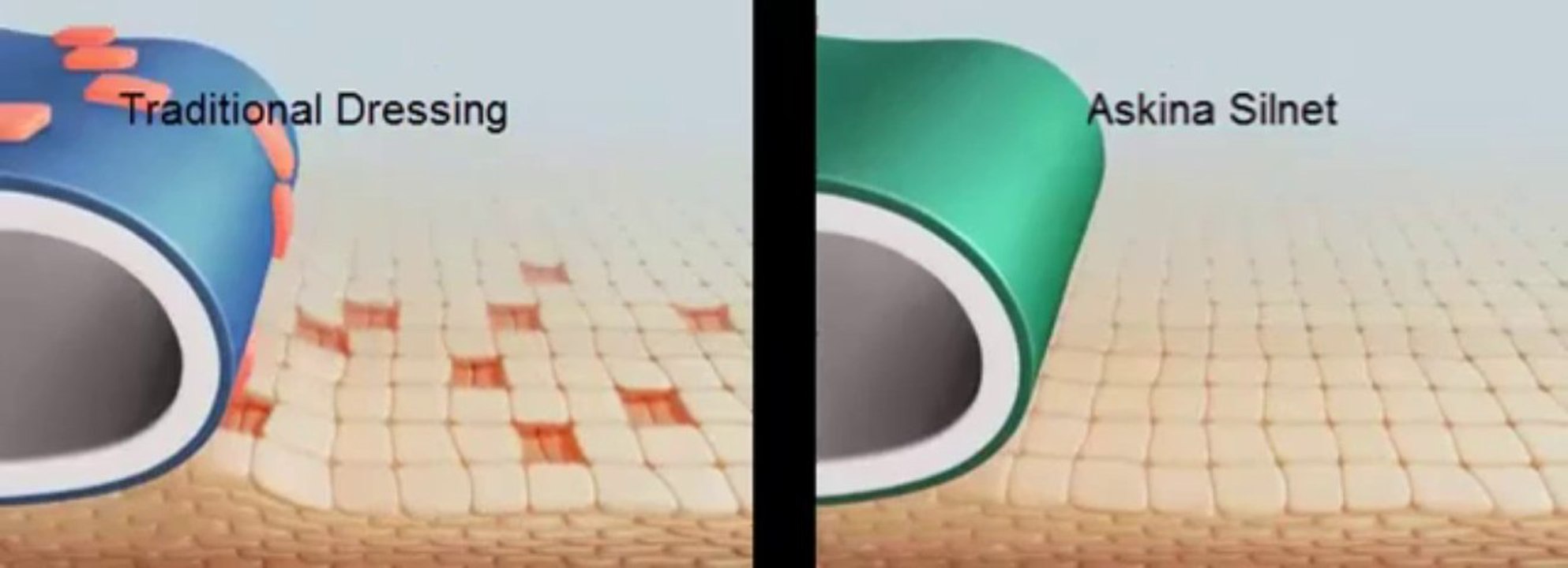 Askina Silnet wound dressing