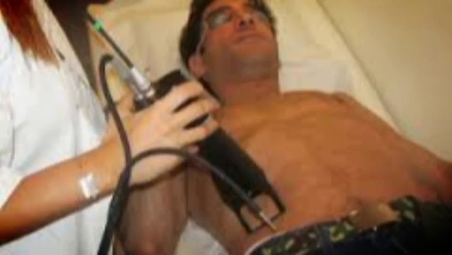 Does Laser Hair Removal Work