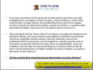 Cura Para el Acne *LOS SECRETOS*