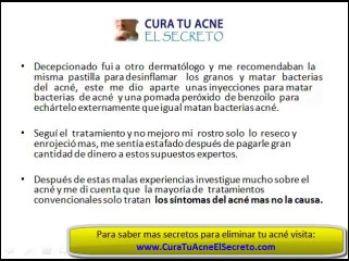 Como Eliminar el Acne - LOS SECRETOS