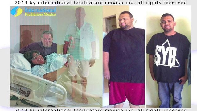Weight Loss Surgery,Lap Band, Tijuana Mexico by Sheri Burke