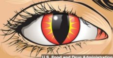 FDA Cautions Against Colored Contact Lenses Sold Illegally