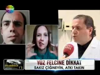 Descargar video: Yüz Felci Nedir-Yüz Felcinin Nedenleri Tedavisi-Yüz Felci Nasıl Geçer Tedavi Edilir