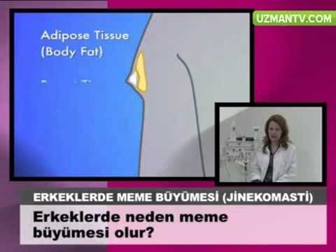 erkeklerde göğüs büyümesi nedenleri-erkeklerde meme yağlanması jinekomasti tedavisi