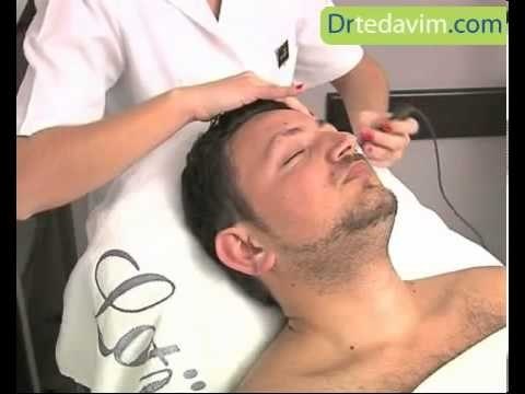 Sivilce İzleri Nasıl Geçer-Sivilce Lekeleri İçin Tedavi Yolları