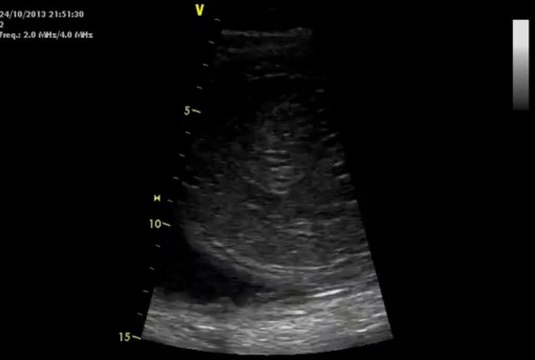 Echographie In Utero D Un Poulain De 5 Mois Video Dailymotion