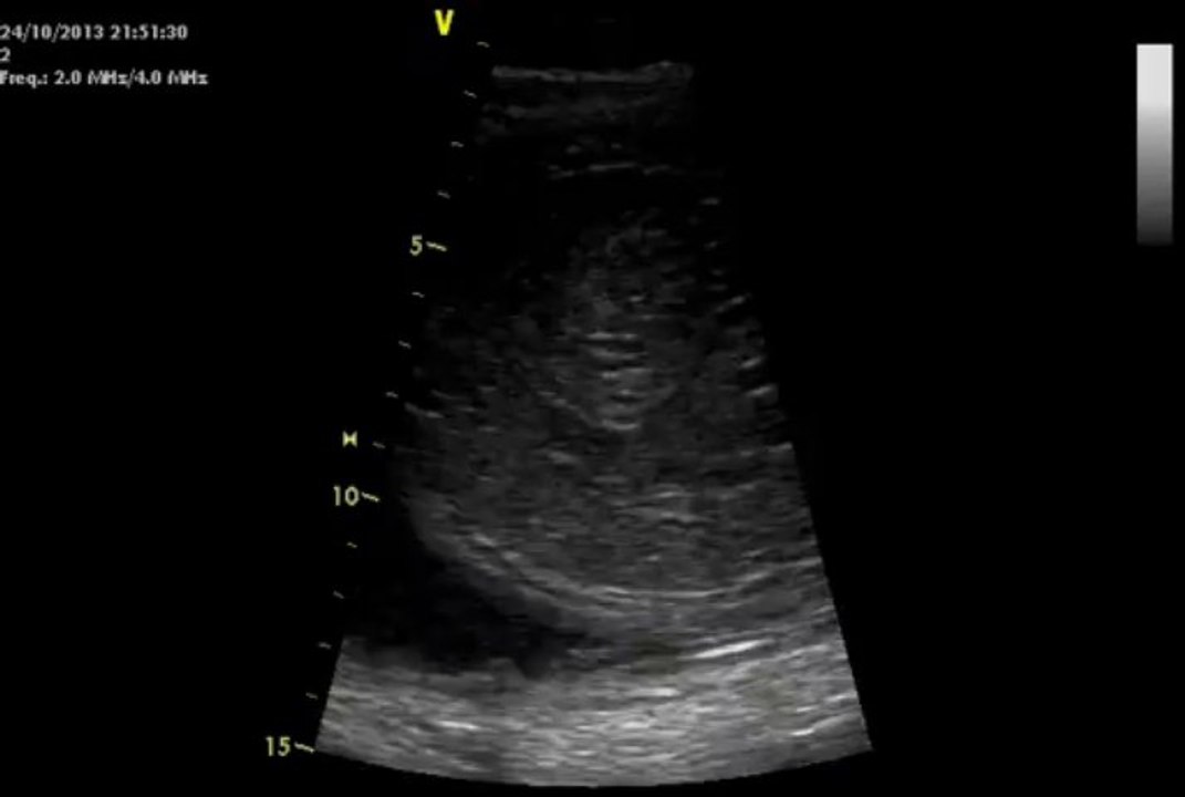 Échographie in utero d'un poulain de 5 mois