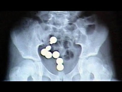 Three Lao women arrested for hiding 4,000 meth pills inside their bodies