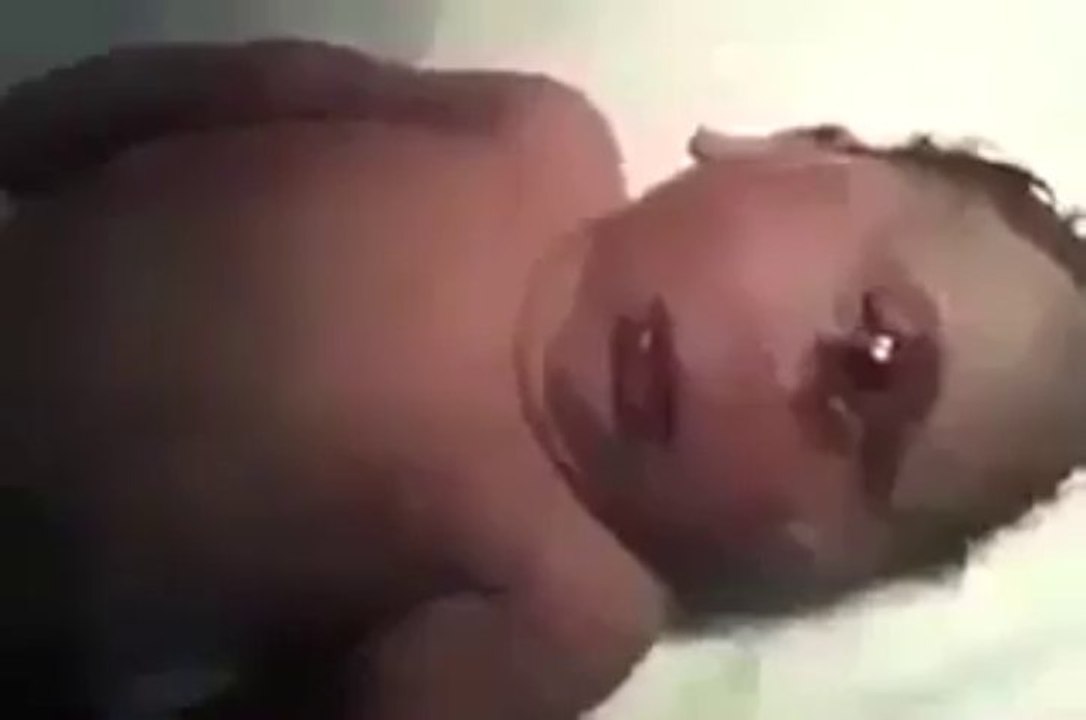www.vustudents.ning.com - Real or Fake Cyclops Baby Born with one Eye in Israel!