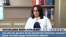 Çocuklarda görülen besin alerjilerinin belirtileri nelerdir ?