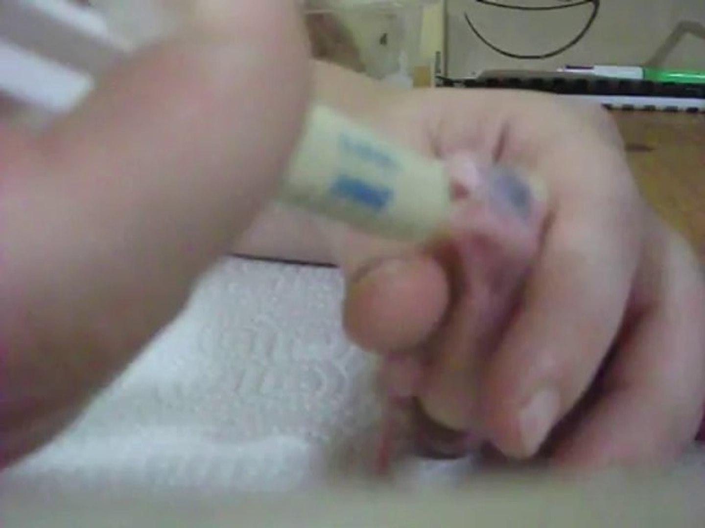 Nourrissage Calopsitte De 11 Jours Video Dailymotion