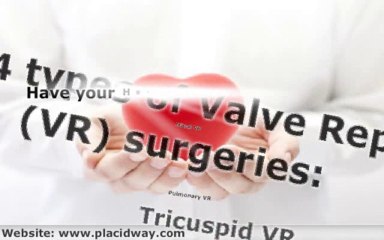 Top Heart Valve Replacement Surgery in India