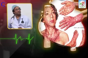 Alcohol and Heart Disease - Circulation - Dr.Y.P.RAJU