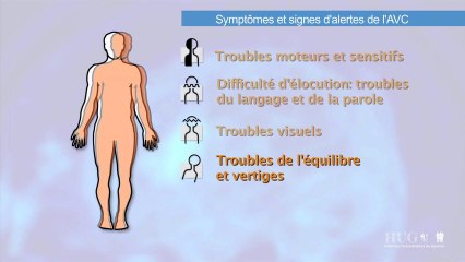 Symptômes et signes d'alerte de l'AVC