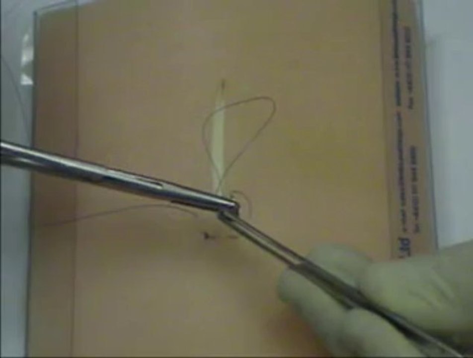 Skin_Suture_mattress