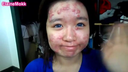 How to hide you ACNE with MAKEUP...