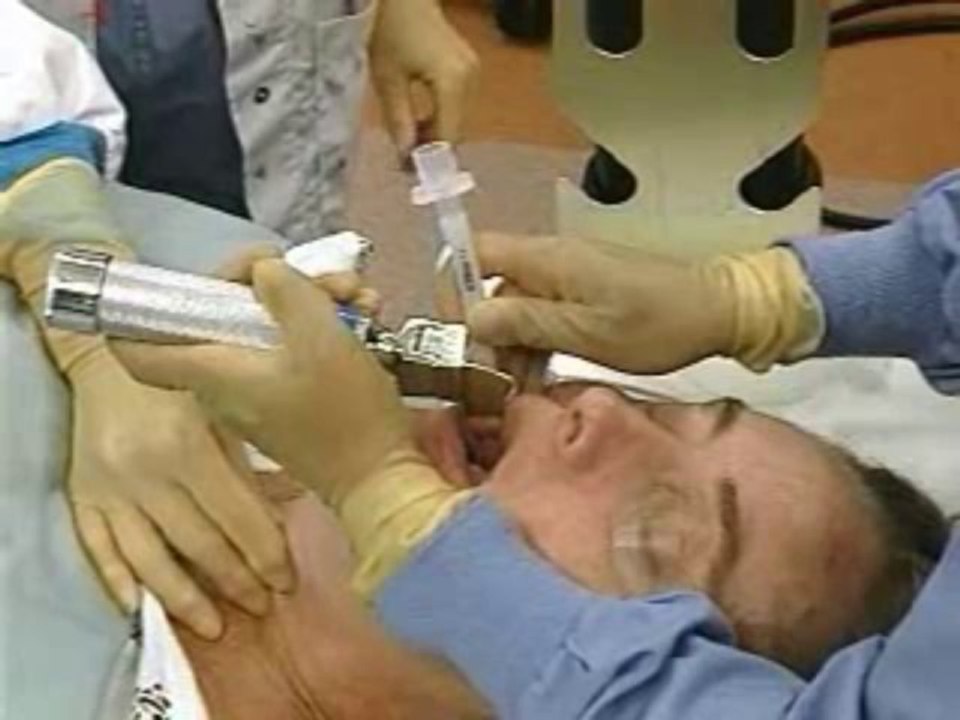 AirwayManagmentNonSurgical