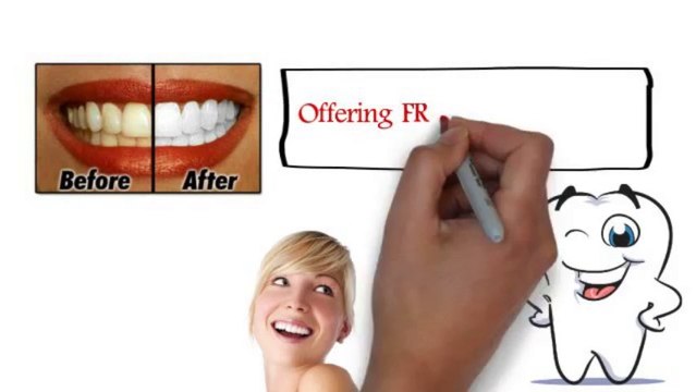 Get a Bright and White Smile | Free Teeth Whitening in Shelby