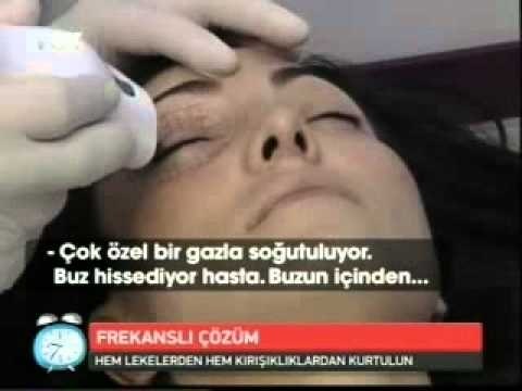 Radyofrekans ile cilt gençleştirme ve cilt lekeleri tedavisi