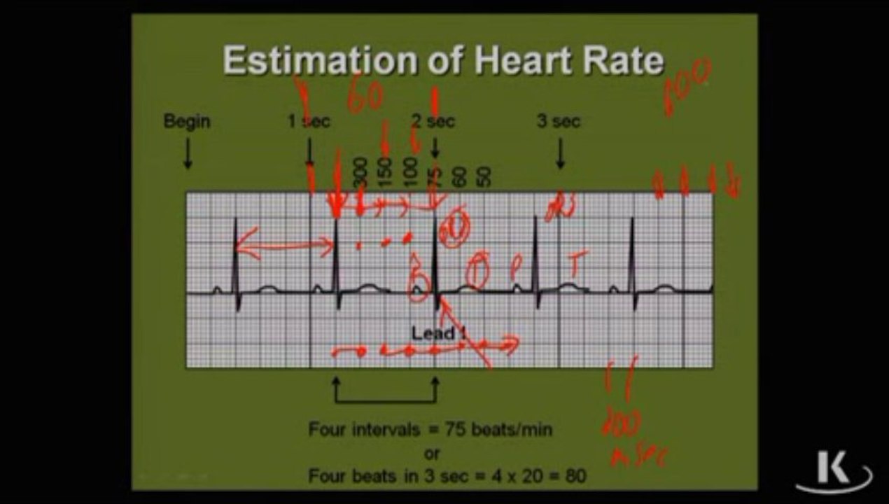 Physio_Fischer_Sec02_Ch03e_Electrocardiology_xvid