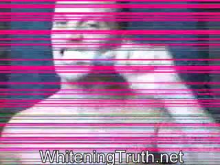 Can You Really Utilize Banana Peels to Whiten Your Pearly whites?