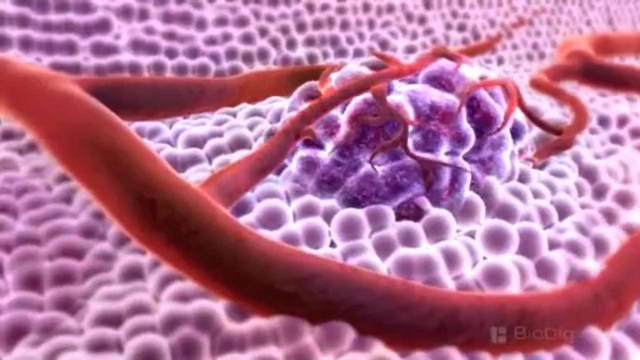 Cancer